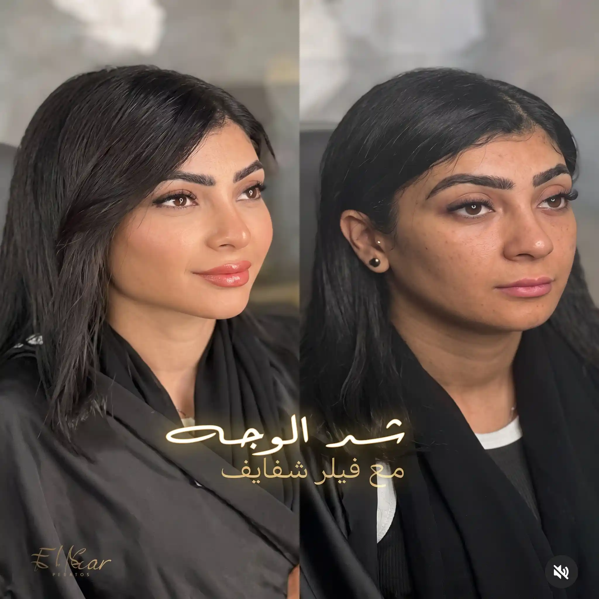 شد الوجه المائي